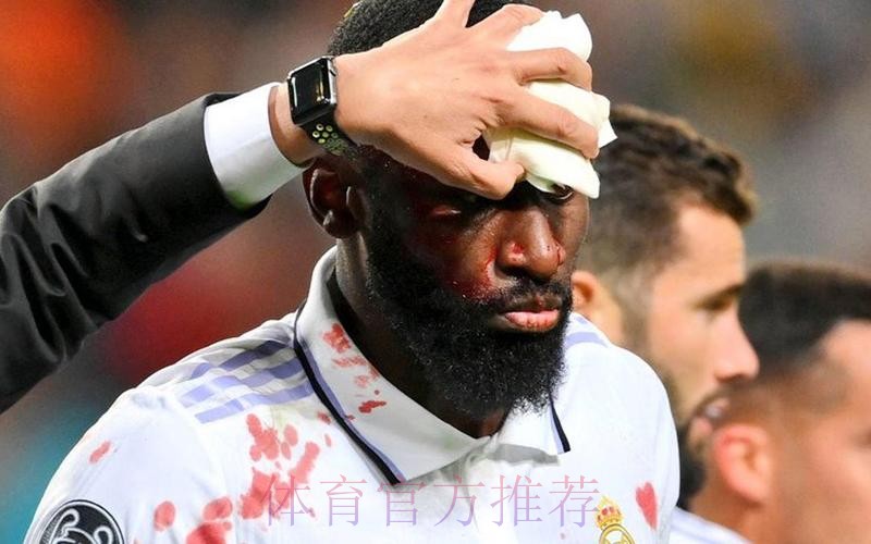 球衣全是血!皇马英雄95分钟舍身绝平 赛后缝20针 球衣全是血!皇马英雄95分钟舍身绝平 赛后缝20针